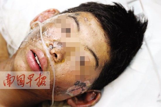 廣西：迎親車上20余萬(wàn)響鞭炮被引燃 5人被炸傷(圖)