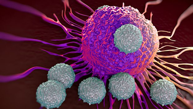 Cancer patients surviving longer in the UK 英國癌癥患者存活時(shí)間延長