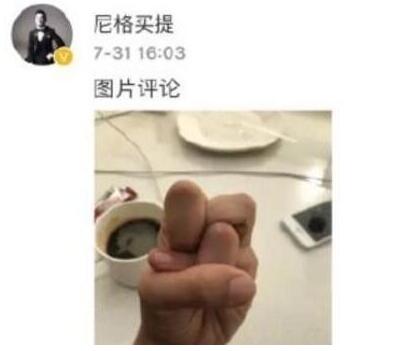 一般人做不出的張一山秋水誓？醫(yī)生：這是??！