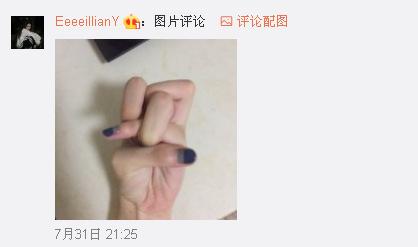 一般人做不出的張一山秋水誓？醫(yī)生：這是??！